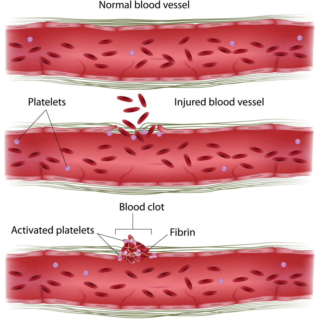 Free redhead clot pic